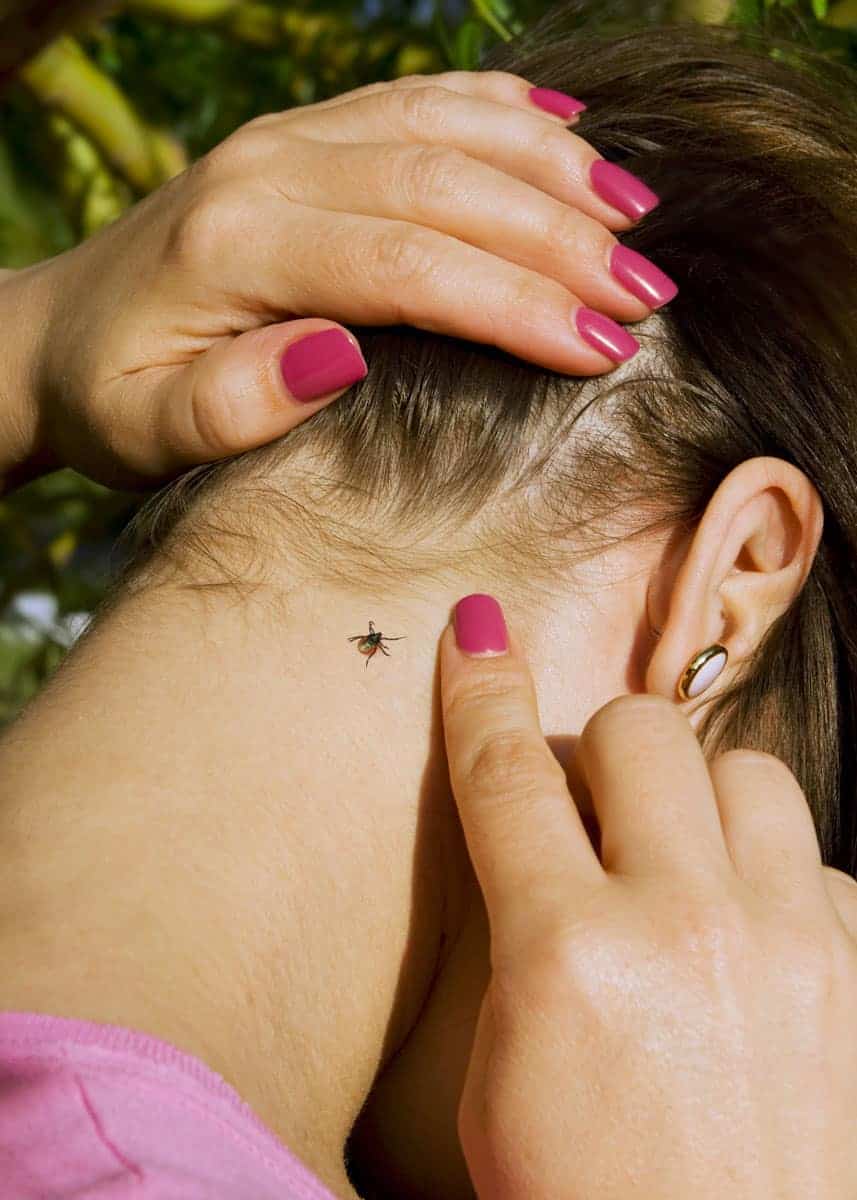 how to remove a tick head from a human